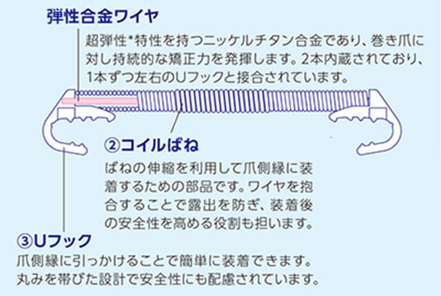 巻き爪治療